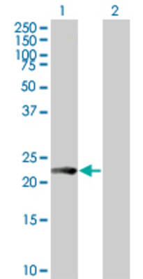 Lane 1: VEGFB transfected lysate (21.6 KDa) Lane 2: Non-transfected lysate.