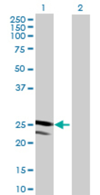 Lane 1: TMED4 transfected lysate (25.08 KDa) Lane 2: Non-transfected lysate.