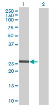 Lane 1: RDH13 transfected lysate (28.71 KDa) Lane 2: Non-transfected lysate.