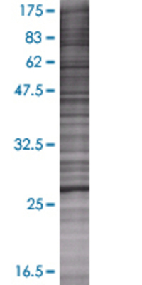 RDH13 transfected lysate.