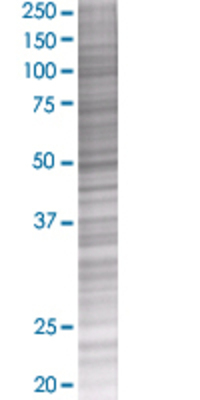 COL23A1 transfected lysate.