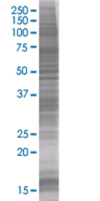 SFRS1 transfected lysate