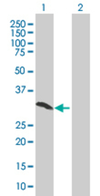 Lane 1: SFRS1 transfected lysate (27.39 KDa). Lane 2: Non-transfected lysate.