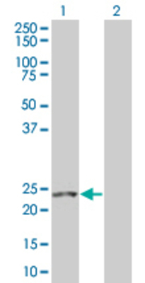 Lane 1: RHOF transfected lysate (18.9 KDa). Lane 2: Non-transfected lysate.
