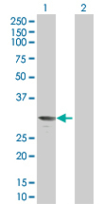 Lane 1: PRTN3 transfected lysate (27.8 KDa). Lane 2: Non-transfected lysate.