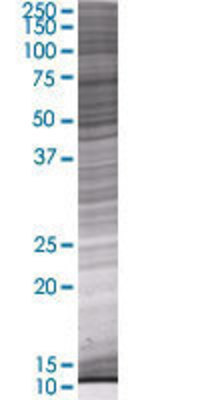 RCBTB2 transfected lysate.