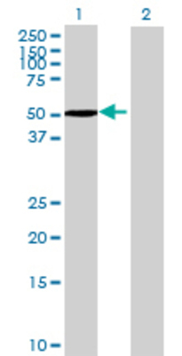 Lane 1: RCBTB2 transfected lysate (60.72 KDa) Lane 2: Non-transfected lysate.