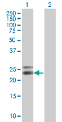 Lane 1: NTF5 transfected lysate (22.4 KDa) Lane 2: Non-transfected lysate.