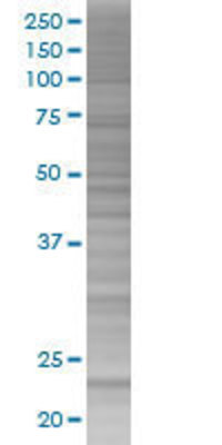 ARL11 transfected lysate.