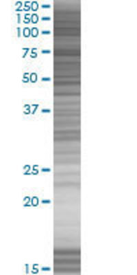 HBP1 transfected lysate.