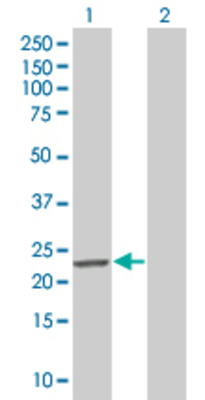 Lane 1: GAJ transfected lysate (22.66 KDa). Lane 2: Non-transfected lysate.