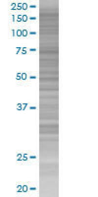 PCDH10 transfected lysate.