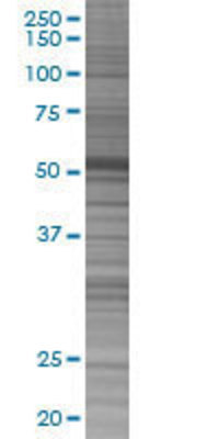 CAMK2B transfected lysate.
