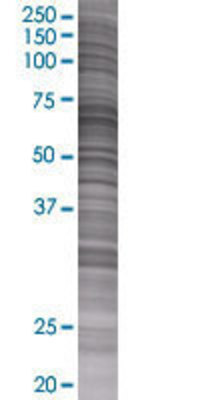 ATIC transfected lysate.
