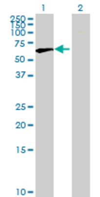 Lane 1: ATIC transfected lysate (65.23 KDa) Lane 2: Non-transfected lysate.