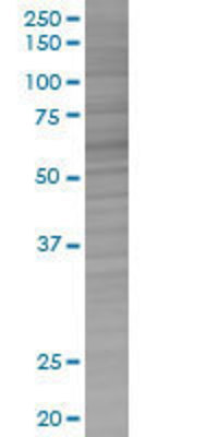 UNC5CL transfected lysate.