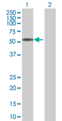 Lane 1: UNC5CL transfected lysate (57.7 KDa) Lane 2: Non-transfected lysate.