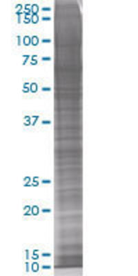 FANCA transfected lysate