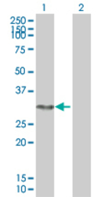 Lane 1: FANCA transfected lysate (32.78 KDa). Lane 2: Non-transfected lysate.