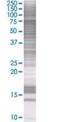 GAS6 transfected lysate.