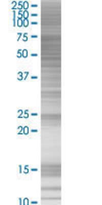 HBS1L transfected lysate.