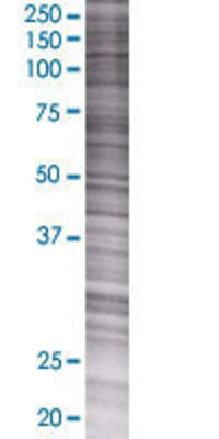SPR transfected lysate.