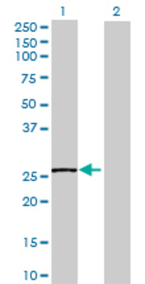 Lane 1: SPR transfected lysate (28.82 KDa) Lane 2: Non-transfected lysate.