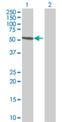 Lane 1: FANCC transfected lysate (63.4 KDa) Lane 2: Non-transfected lysate.