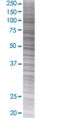FANCC transfected lysate.