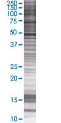 HSFY1 transfected lysate.