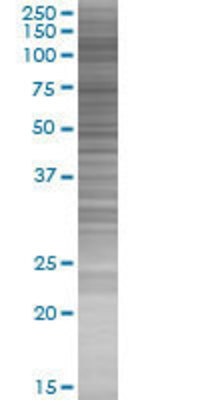 HIRA transfected lysate.