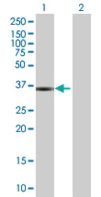 Lane 1: THOC6 transfected lysate (34.87 KDa) Lane 2: Non-transfected lysate.