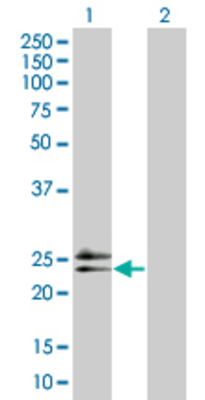Lane 1: RAD54B transfected lysate (18.6 KDa) Lane 2: Non-transfected lysate.