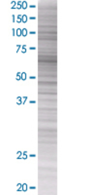 FANCG transfected lysate.