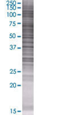 APOA5 transfected lysate.