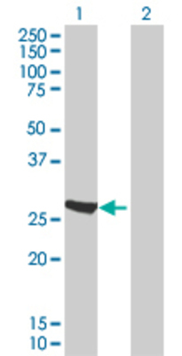 Lane 1: SLC25A27 transfected lysate (27.06 KDa). Lane 2: Non-transfected lysate.