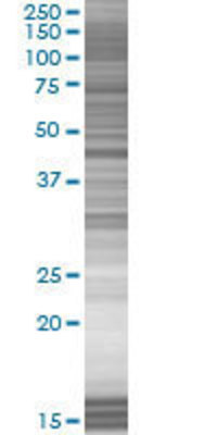 ASPA transfected lysate.