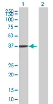 Lane 1: ASPA transfected lysate (34.54 KDa) Lane 2: Non-transfected lysate.
