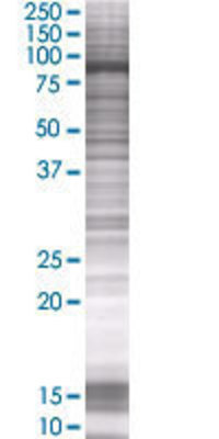 VPS39 transfected lysate.