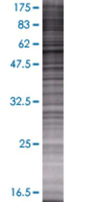 DDX56 transfected lysate.