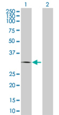 Lane 1: CTRB1 transfected lysate (28.93 KDa) Lane 2: Non-transfected lysate.