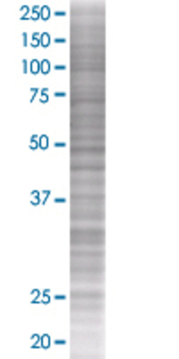 CTRB1 transfected lysate.