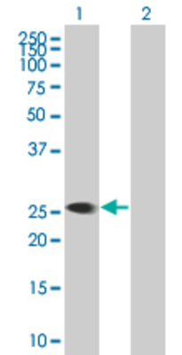 Lane 1: KYNU transfected lysate (33.88 KDa) Lane 2: Non-transfected lysate.