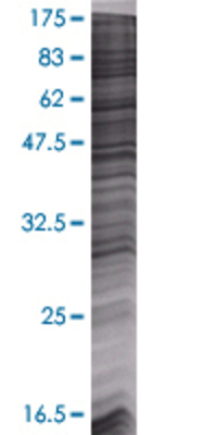 SIRT5 transfected lysate.