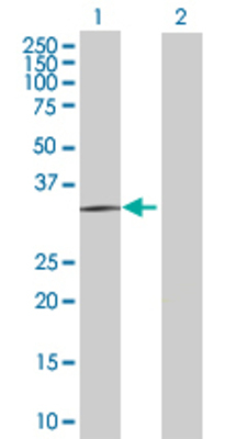 Lane 1: SIRT5 transfected lysate (34.21 KDa) Lane 2: Non-transfected lysate.
