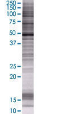 BLMH transfected lysate.