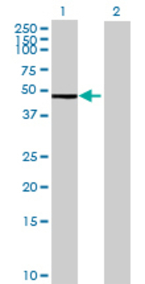 Lane 1: BLMH transfected lysate (50.16 KDa) Lane 2: Non-transfected lysate.