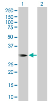 Lane 1: HOXB1 transfected lysate (25.96 KDa) Lane 2: Non-transfected lysate.