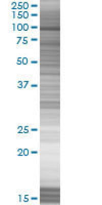 TNK2 transfected lysate.