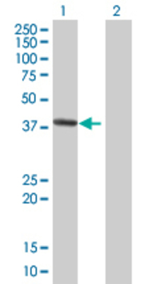 Lane 1: TNK2 transfected lysate (38.83 KDa) Lane 2: Non-transfected lysate.